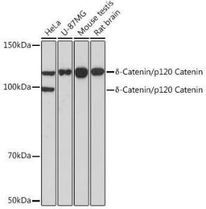 Western blot analysis of extracts of various cell lines, using Anti-delta 1 Catenin/CAS Antibody [ARC0586] (A81041) at 1:1,000 dilution The secondary antibody was Goat Anti-Rabbit IgG H&L Antibody (HRP) at 1:10,000 dilution Lysates/proteins were present at 25 µg per lane