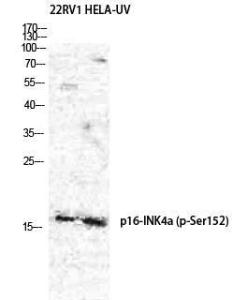 Anti-p16-INK4a