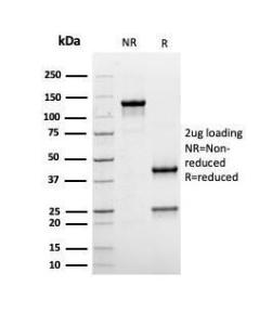 Anti-Albumin antibody