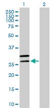 Anti-MRPL2 Mouse Polyclonal Antibody