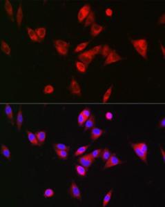 Immunofluorescence analysis of Hep G2 cells using Anti-BAAT Antibody (A10180) at a dilution of 1:200 (40X lens). DAPI was used to stain the cell nuclei (blue)