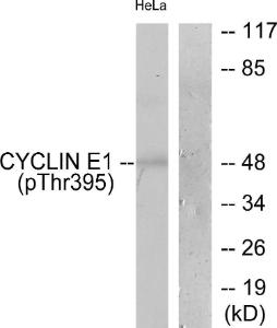 Antibody anti-cyclin E1 phospho THR395