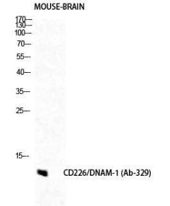 Western blot analysis of mouse brain cells using Anti-CD226 Antibody