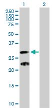 Anti-C9ORF152 Mouse Polyclonal Antibody