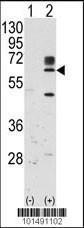 Anti-RYK Rabbit Polyclonal Antibody (AP (Alkaline Phosphatase))