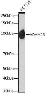 Western blot analysis of extracts of HCT116 cells, using Anti-ADAM15 Antibody [ARC1419] (A308455) at 1:1,000 dilution