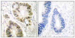 Antibody anti-cyclin E1 phospho THR395