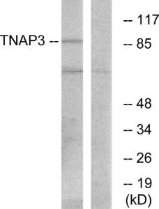 Western blot analysis of lysates from RAW264.7 cells using Anti-TNAP3 Antibody. The right hand lane represents a negative control, where the antibody is blocked by the immunising peptide.