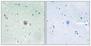 Anti-EDG8 antibody