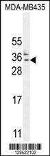 Anti-CK073 Rabbit Polyclonal Antibody (AP (Alkaline Phosphatase))