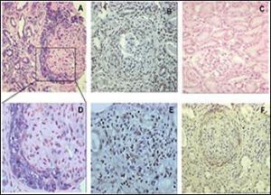 Anti-GREM1 Rabbit Polyclonal Antibody (AP (Alkaline Phosphatase))