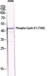 Antibody anti-cyclin E1 phospho THR395