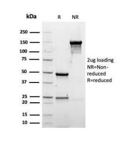 SDS-PAGE analysis of Anti-Albumin Antibody [rALB/6412] under non-reduced and reduced conditions; showing intact IgG and intact heavy and light chains, respectively. SDS-PAGE analysis confirms the integrity and purity of the antibody