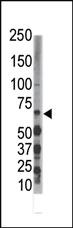 Anti-DYRK3 Rabbit Polyclonal Antibody