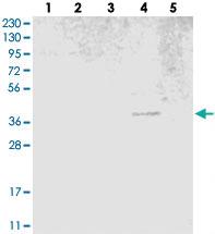 Anti-SVOPL Rabbit Polyclonal Antibody