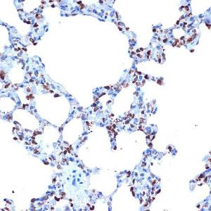 Immunohistochemistry analysis of paraffin-embedded rat lung using Anti-ADAM15 Antibody [ARC1419] (A308455) at a dilution of 1:100 (40X lens). Perform microwave antigen retrieval with 10 mM Tris/EDTA buffer pH 9.0 before commencing with IHC staining protocol