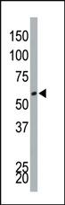 Anti-DYRK4 Rabbit Polyclonal Antibody