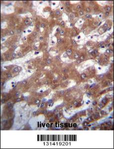 Anti-TRUB1 Rabbit Polyclonal Antibody