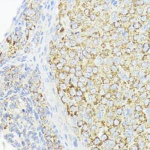 Immunohistochemistry analysis of paraffin-embedded rat ovary using Anti-BMPR1B Antibody (A307509) at a dilution of 1:200 (40X lens). Perform microwave antigen retrieval with 10 mM PBS buffer pH 7.2 before commencing with IHC staining protocol