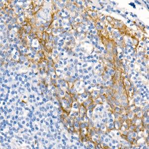 Immunohistochemistry analysis of paraffin-embedded human tonsil using Anti-delta 1 Catenin/CAS Antibody [ARC0586] (A81041) at a dilution of 1:500 (40x lens) Perform microwave antigen retrieval with 10 mM PBS buffer pH 72 before commencing with IHC staining protocol