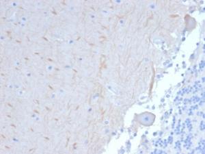 Anti-ATG5 antibody