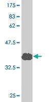 Anti-DDX54 Mouse Monoclonal Antibody [clone: 2E4]