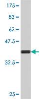 Anti-EVC Mouse Polyclonal Antibody