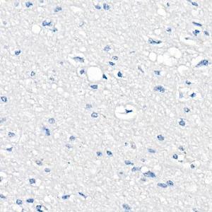 Immunohistochemistry analysis of paraffin-embedded human brain (negative control sample) using Anti-delta 1 Catenin/CAS Antibody [ARC0586] (A81041) at a dilution of 1:500 (40x lens) Perform microwave antigen retrieval with 10 mM PBS buffer pH 72 before commencing with IHC staining protocol