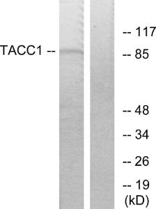 Western blot analysis of lysates from K562 cells using Anti-TACC1 Antibody. The right hand lane represents a negative control, where the Antibody is blocked by the immunising peptide