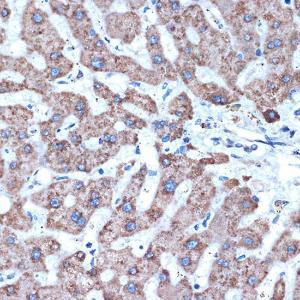 Immunohistochemistry analysis of paraffin-embedded human liver using Anti-ADAM15 Antibody [ARC1419] (A308455) at a dilution of 1:100 (40X lens). Perform microwave antigen retrieval with 10 mM Tris/EDTA buffer pH 9.0 before commencing with IHC staining protocol