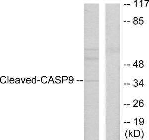 Western blot analysis of lysates from HeLa cells, treated with Etoposide 25uM 60' using Anti-Caspase 9 (cleaved Asp330) Antibody The right hand lane represents a negative control, where the antibody is blocked by the immunising peptide