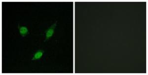 Immunofluorescence analysis of MCF7 cells using Anti-TACC1 Antibody. The right hand panel represents a negative control, where the Antibody was pre-incubated with the immunising peptide