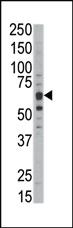 Anti-DYRK1B Rabbit Polyclonal Antibody