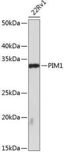 Western blot analysis of extracts of 22Rv1 cells, using Anti-PIM1 Antibody [ARC0175] (A307510) at 1:1,000 dilution The secondary antibody was Goat Anti-Rabbit IgG H&L Antibody (HRP) at 1:10,000 dilution Lysates/proteins were present at 25 µg per lane