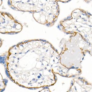 Immunohistochemistry analysis of paraffin-embedded human placenta using Anti-delta 1 Catenin/CAS Antibody [ARC0586] (A81041) at a dilution of 1:500 (40x lens) Perform microwave antigen retrieval with 10 mM PBS buffer pH 72 before commencing with IHC staining protocol