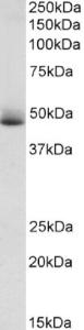 EB08762 (1 µg/ml) staining of Human Albumin-depleted Plasma lysate (35 µg protein in RIPA buffer). Primary incubation was 1 hour. Detected by chemiluminescence.