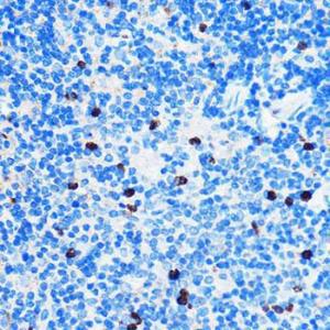 Immunohistochemistry analysis of paraffin-embedded mouse spleen using Anti-Chk1 Antibody (A10183) at a dilution of 1:50 (40X lens). Perform microwave antigen retrieval with 10 mM PBS buffer pH 7.2 before commencing with IHC staining protocol