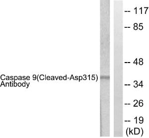 Western blot analysis of lysates from 293 cells, treated with Etoposide 25uM 60' using Anti-Caspase 9 (cleaved Asp315) Antibody The right hand lane represents a negative control, where the antibody is blocked by the immunising peptide