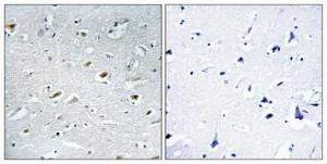 Immunohistochemical analysis of paraffin-embedded human brain using Anti-TACC1 Antibody 1:100 (4 °C overnight). The right hand panel represents a negative control, where the Antibody was pre-incubated with the immunising peptide