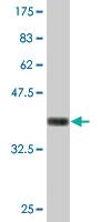 Anti-NID1 Mouse Monoclonal Antibody [clone: 1G3]