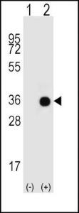 Anti-GNAO1 Rabbit Polyclonal Antibody (FITC (Fluorescein Isothiocyanate))