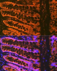 Immunofluorescence analysis of rat rectum using Anti-ADAM15 Antibody [ARC1419] (A308455) at a dilution of 1:100 (40X lens). DAPI was used to stain the cell nuclei (blue)