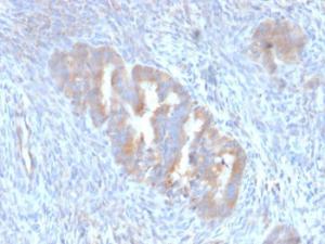 Anti-ATG5 antibody