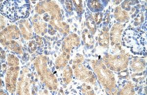 Anti-PRMT1 Rabbit Polyclonal Antibody