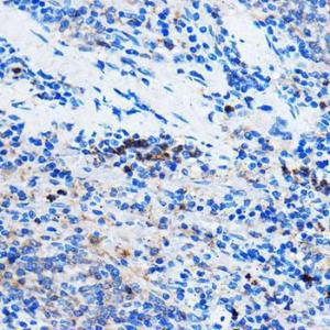 Immunohistochemistry analysis of paraffin-embedded rat spleen using Anti-Chk1 Antibody (A10183) at a dilution of 1:50 (40X lens). Perform microwave antigen retrieval with 10 mM PBS buffer pH 7.2 before commencing with IHC staining protocol