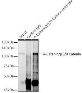 Immunoprecipitation analysis of 600 µg extracts of mouse testis cells using 3 µg of Anti-delta 1 Catenin/CAS Antibody [ARC0586] (A81041) This Western blot was performed on the immunoprecipitate using Anti-delta 1 Catenin/CAS Antibody [ARC0586] (A81041) at a dilution of 1:1000