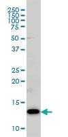 Anti-COX5B Mouse Monoclonal Antibody [clone: 1E8]