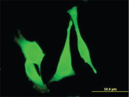 Anti-FZD3 Mouse Monoclonal Antibody [clone: 2H5]