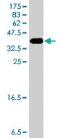 Anti-CDH23 Mouse Polyclonal Antibody