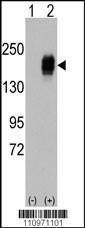 Anti-EGFR Rabbit Polyclonal Antibody (APC (Allophycocyanin))